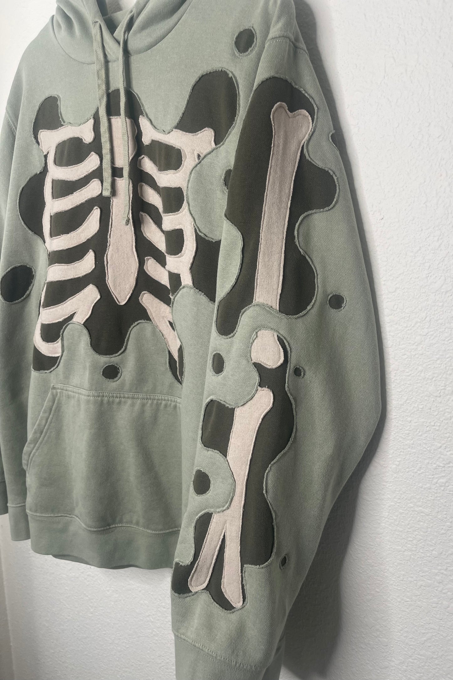 Gangrene